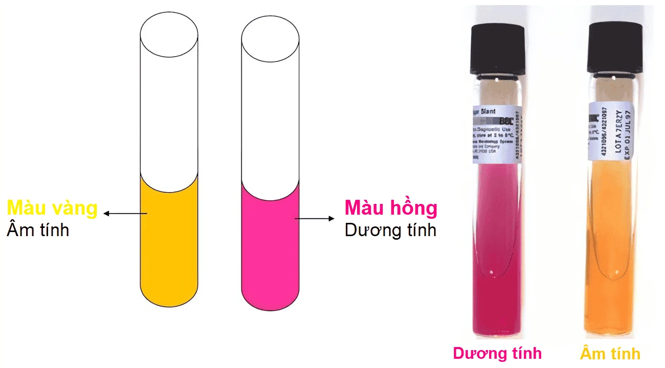 Test HP Urease (H/25 mẫu)